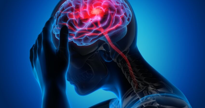 Migraine Scenario