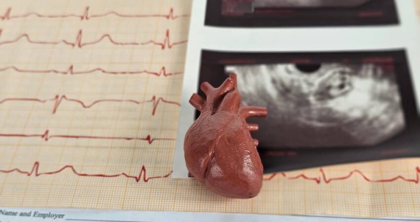 Ecg Work