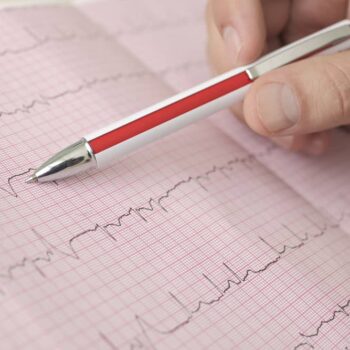 Ecg Work